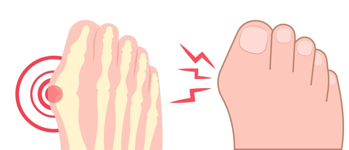 Тянем стопы с помощью полотенца. Сядьте на пол, вытяните ноги вперед. Возьмите полотенце, оберните его вокруг стоп и аккуратно потяните на себя. Удерживайте тело в этом положении как минимум 15 секунд. Повторите упражнение 2–4 раза.