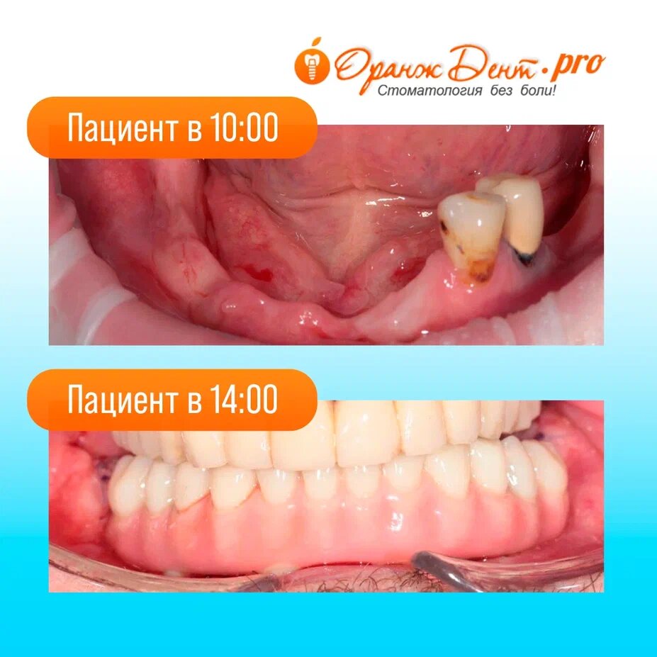 До и после операции