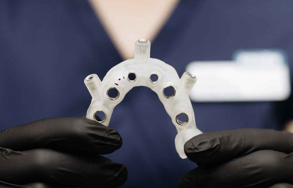 Внешне шаблон напоминает капы, которые надевают спортсмены на зубы для предотвращения травм. 