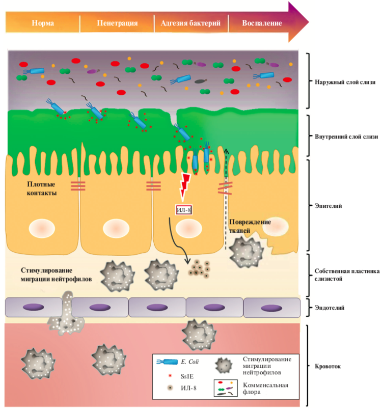 Строение кишечного барьера в норме и патологии. Источник: Valeri M, Rossi Paccani S, Kasendra M, et al. Pathogenic E. coli exploits SslE mucinase activity to translocate through the mucosal barrier and get access to host cells. PLoS One. 2015