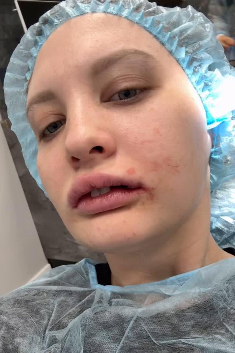    Невестка Королевой перенесла повторную операцию Социальные сети