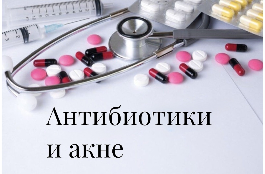 Лечение акне