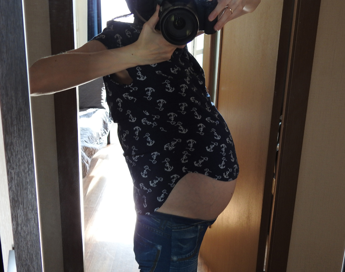 Асцит около 10 литров