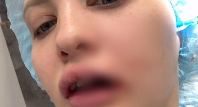    Instagram*/melissa_foxs