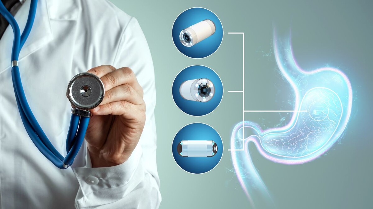 Как пройти эндоскопию без страха и боли: врач рассказывает правду о процедуре 