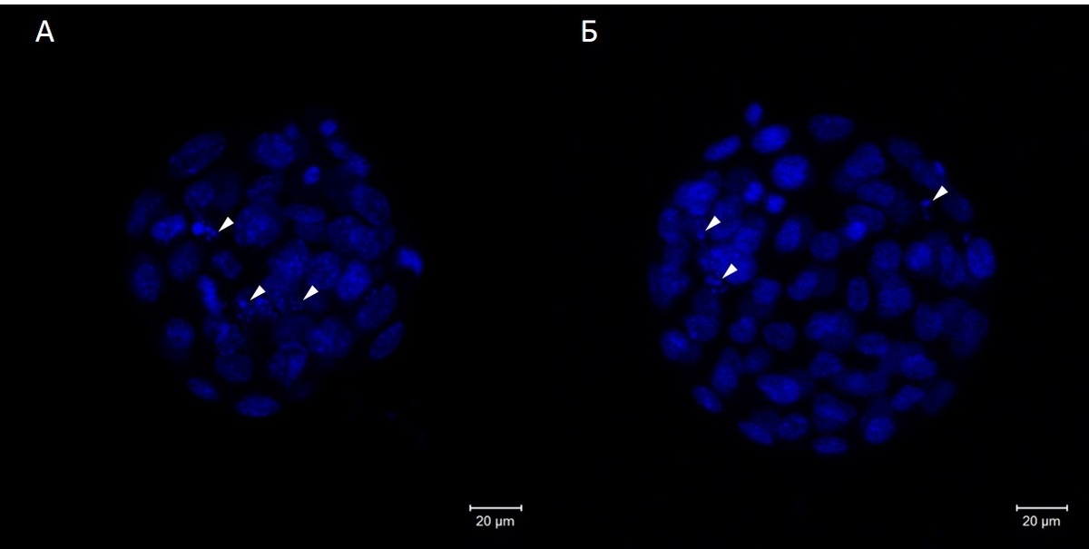 Бластоцисты мышей после 24 ч культивирования in vitro. Окрашивание DAPI.