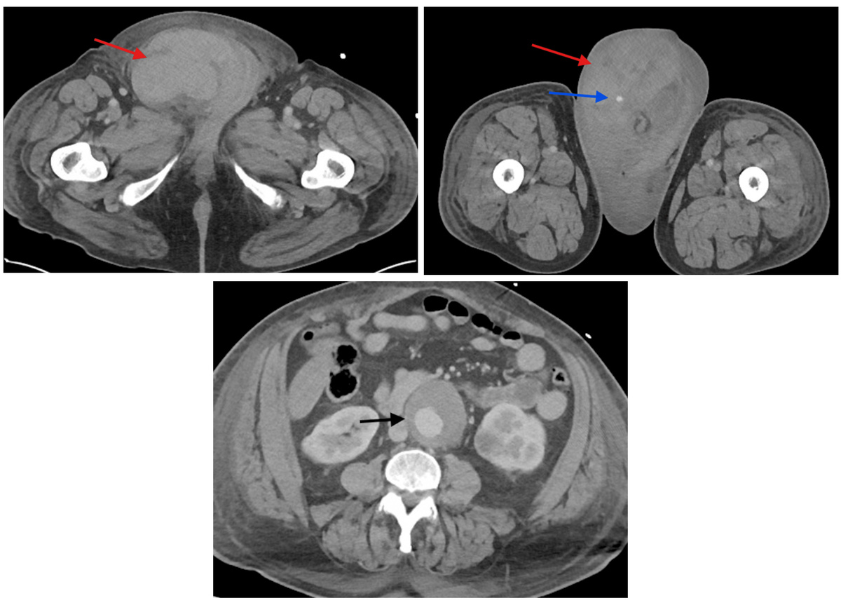  Steven J. Laxton, Jackie Dovgalyuk / Cureus, 2025