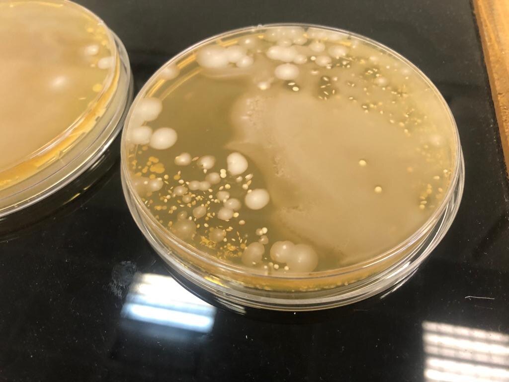 Культура микроорганизмов на чашке Петри. Источник: Альбина Лунева