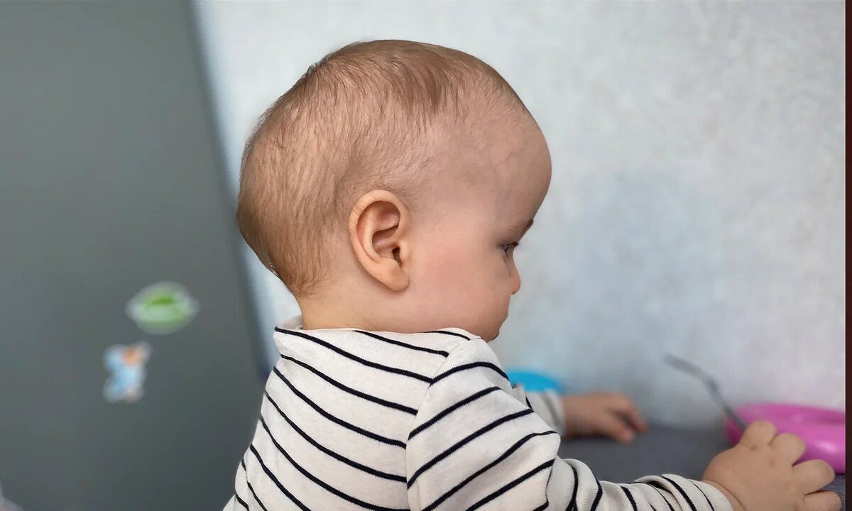 Алим Смаков, подопечный фонда «Алёша»