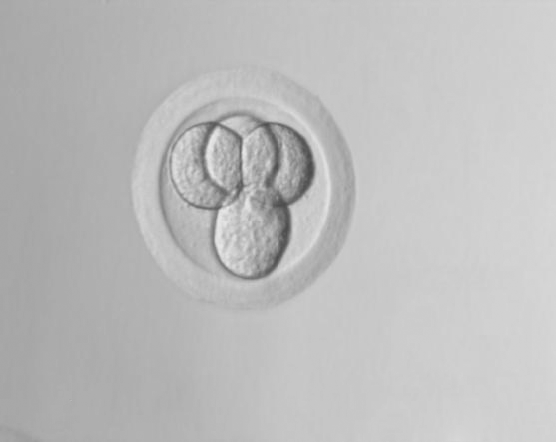 Дробящийся эмбрион хомячка Кэмпбэллана на 3й день развития, окруженный прозрачной
оболочкой. Эмбрион был заморожен на программном замораживателе CL-8800i (CryoLogic) и после хранения при температуре жидкого азота (-196С) был оттаян при 38С.