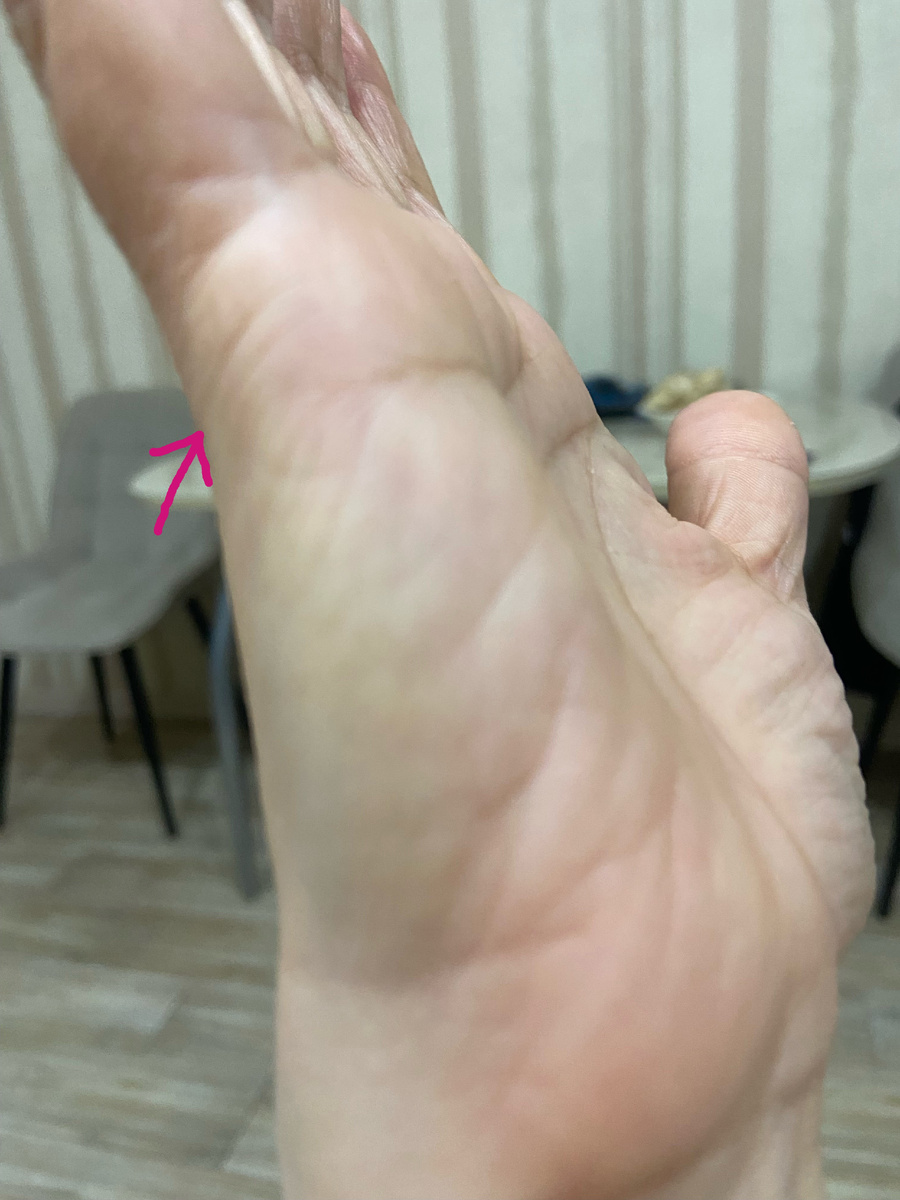 линии брака 