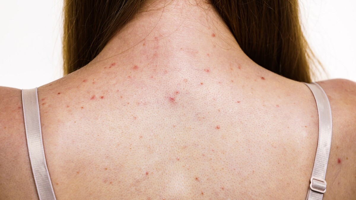    Фото: Shutterstock.com