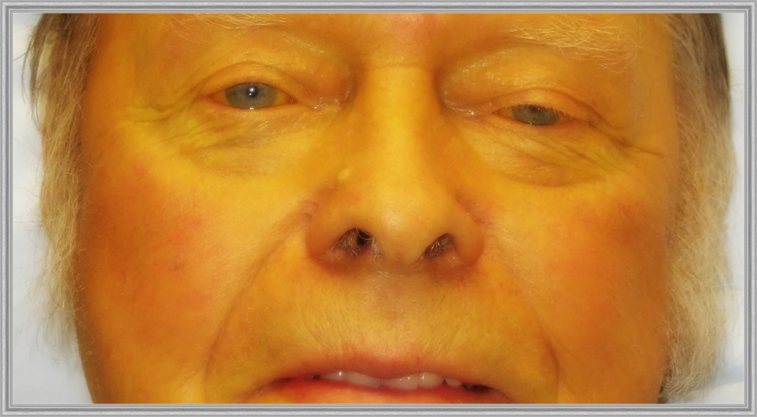 Желтушность кожных покровов и слизистых всегда бывает спровоцирована состояниями, опасными для жизни.
