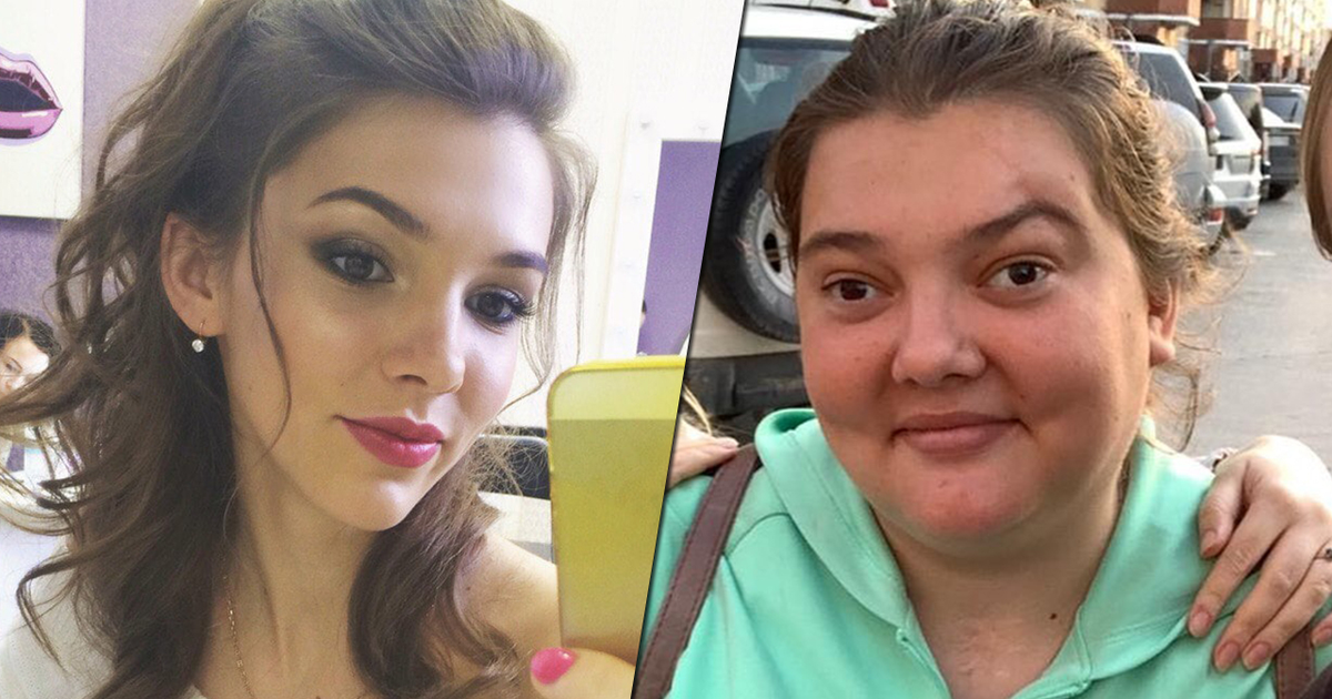 Мария Лебедева до и после ДТП