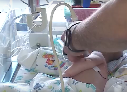     Красноярские врачи провели редчайшую операцию с помощью 3D-технологий