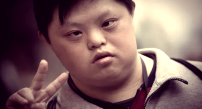 Азиатские дети с синдромом Дауна