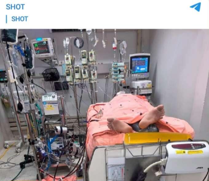 Паша Техник в коме в Таиланде