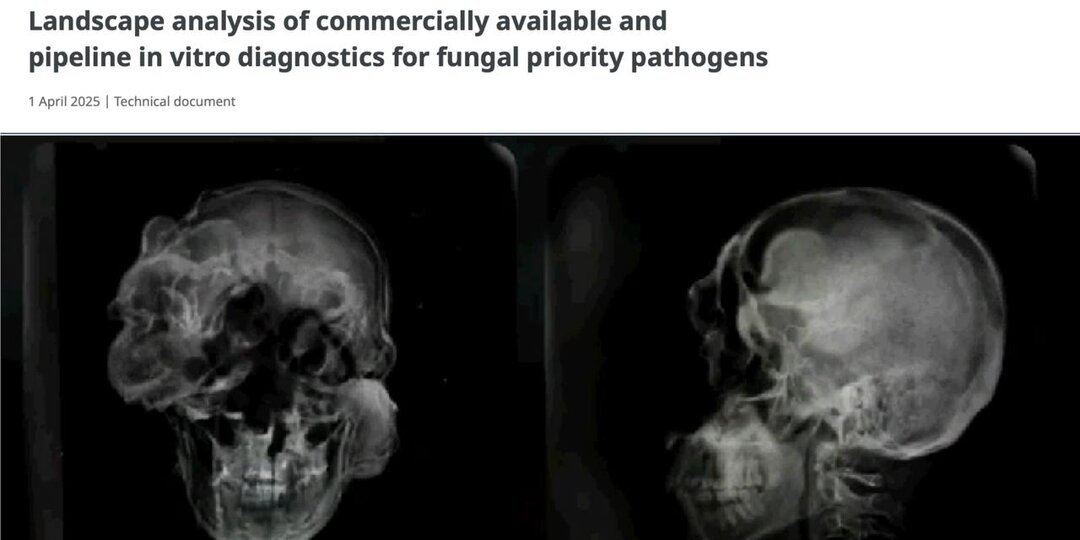 Грибки, которые убивают. И лечить их почти нечем.