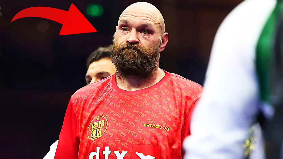 Тайсон Фьюри