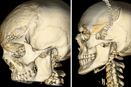   Фото: ННИИТО им. Я.Л. Цивьяна Минздрава России.