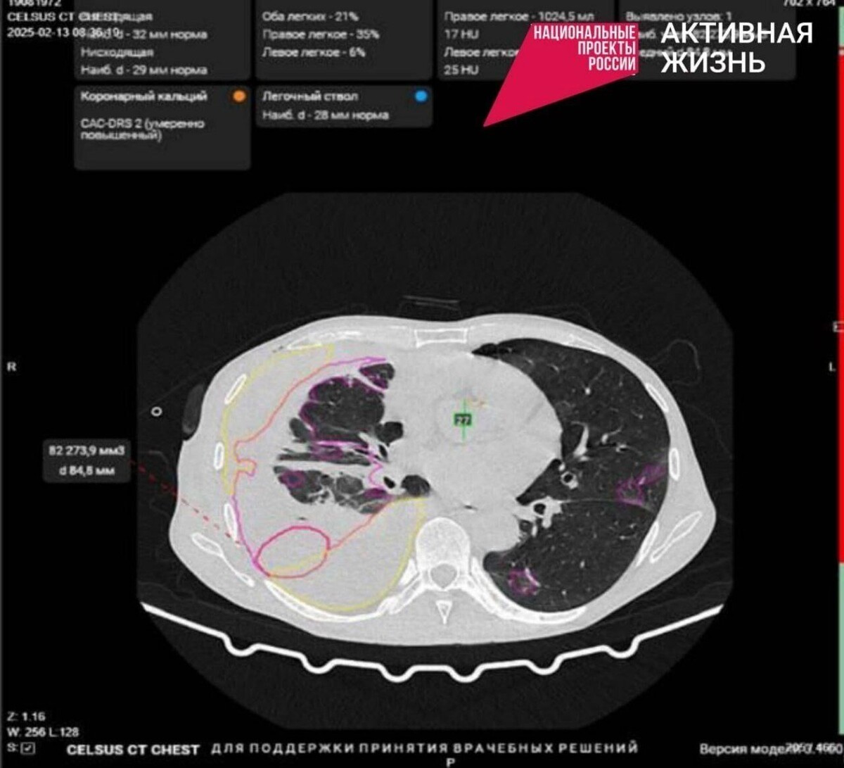     Источник: страница Переверзева