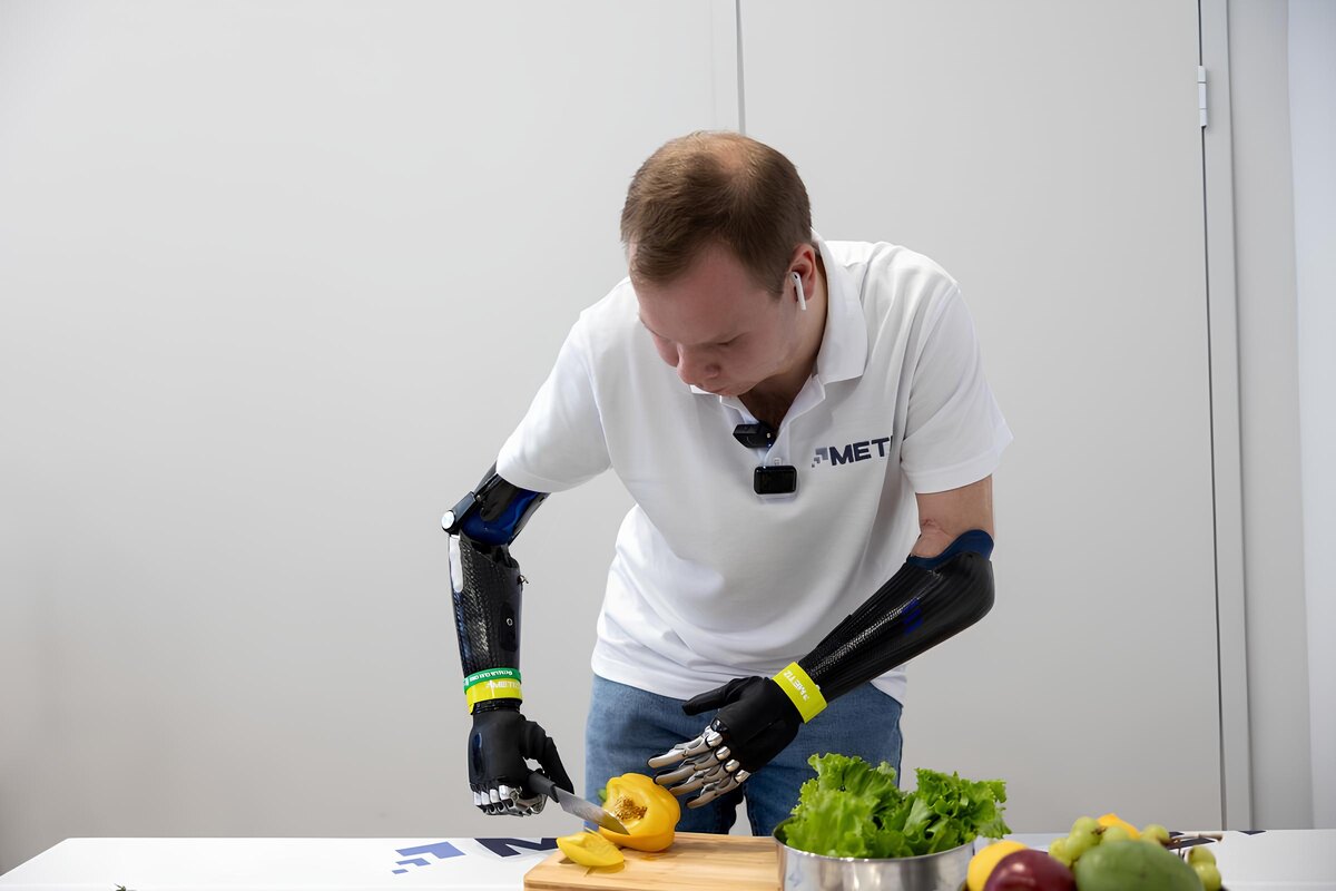 Фото: «Максбионик»