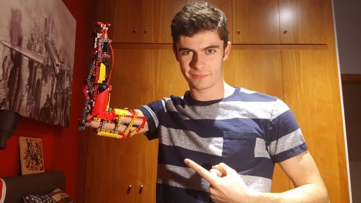 Давид и его Лего-протез