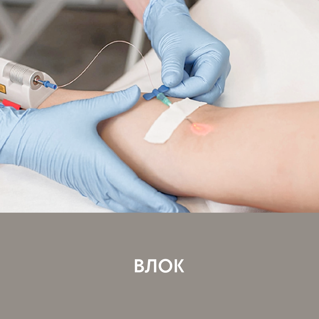  ВЛОК (внутривенное лазерное облучение крови)