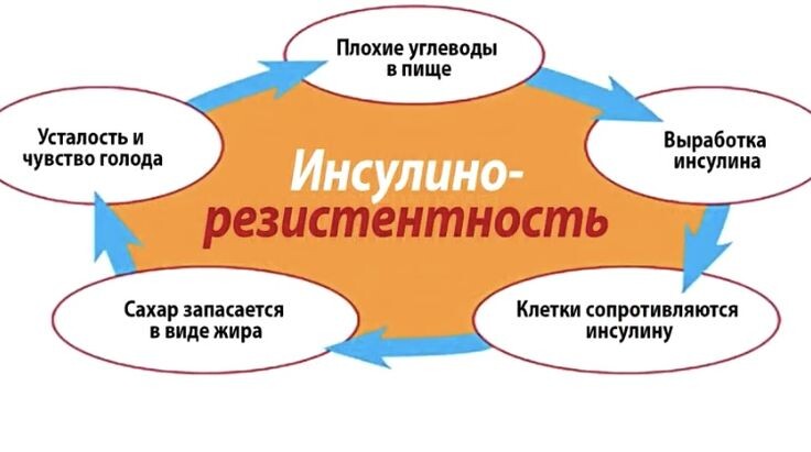Инсулинорезистентность