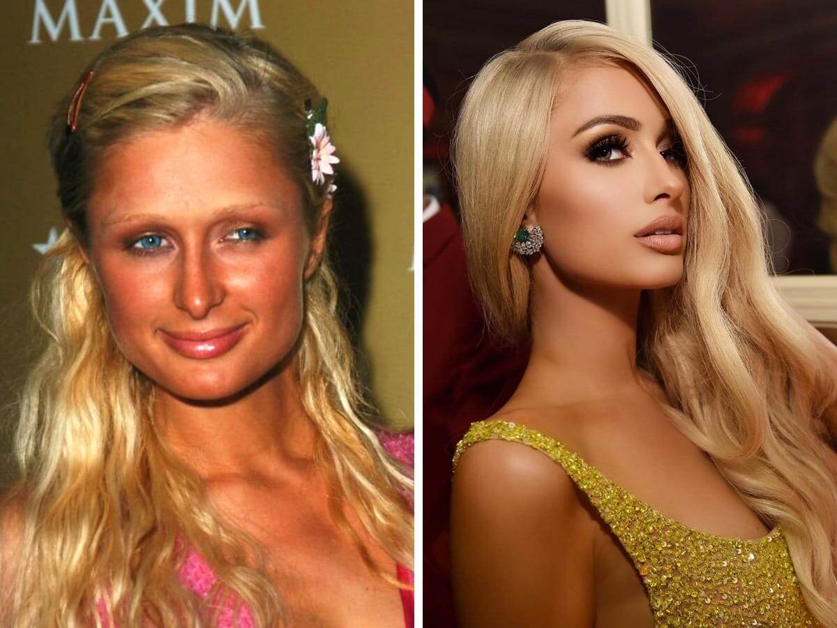 John Sciulli / parishilton