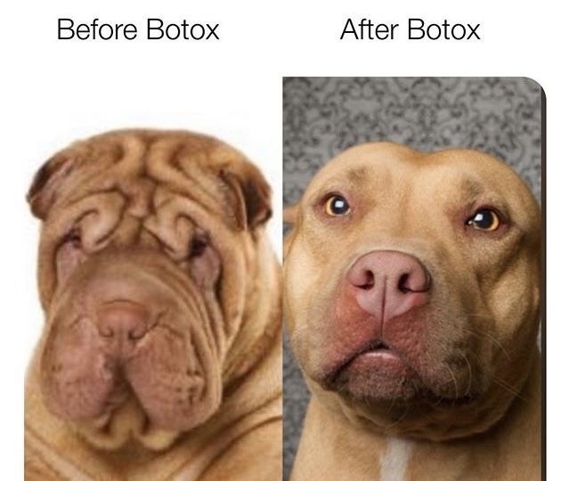 Ботокс. Надо ли?