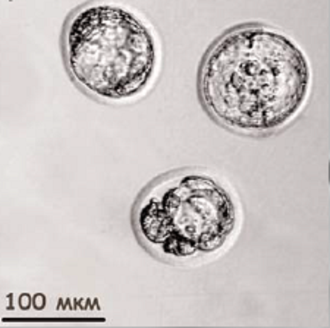 Микрофотографии (световая прижизненная микроскопия) эмбрионов крыс линии OXYS (модель преждевременного старения).