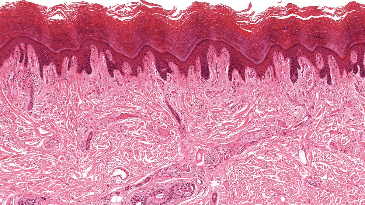 Биопсийный материал под микроскопом