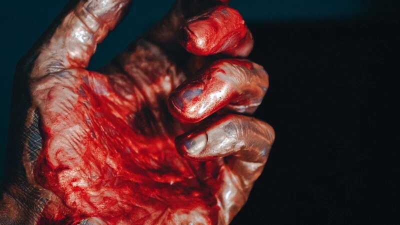     Насилие. Кровь. Рана. https://unsplash.com/