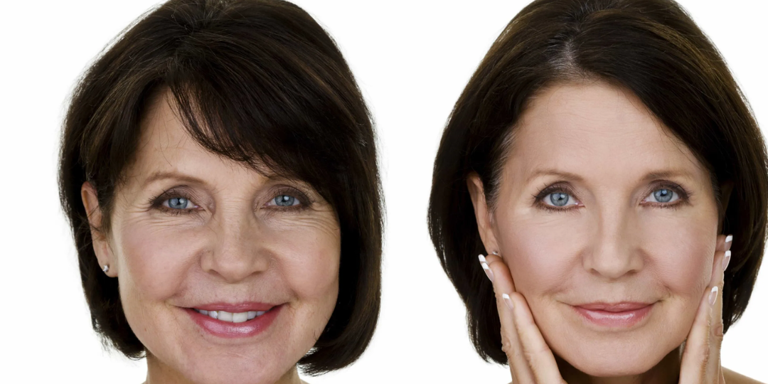 Мифы о морщинах, которые нам навязывают – развеем мифы о морщинах и старении кожи, чтобы мы могли чувствовать себя увереннее