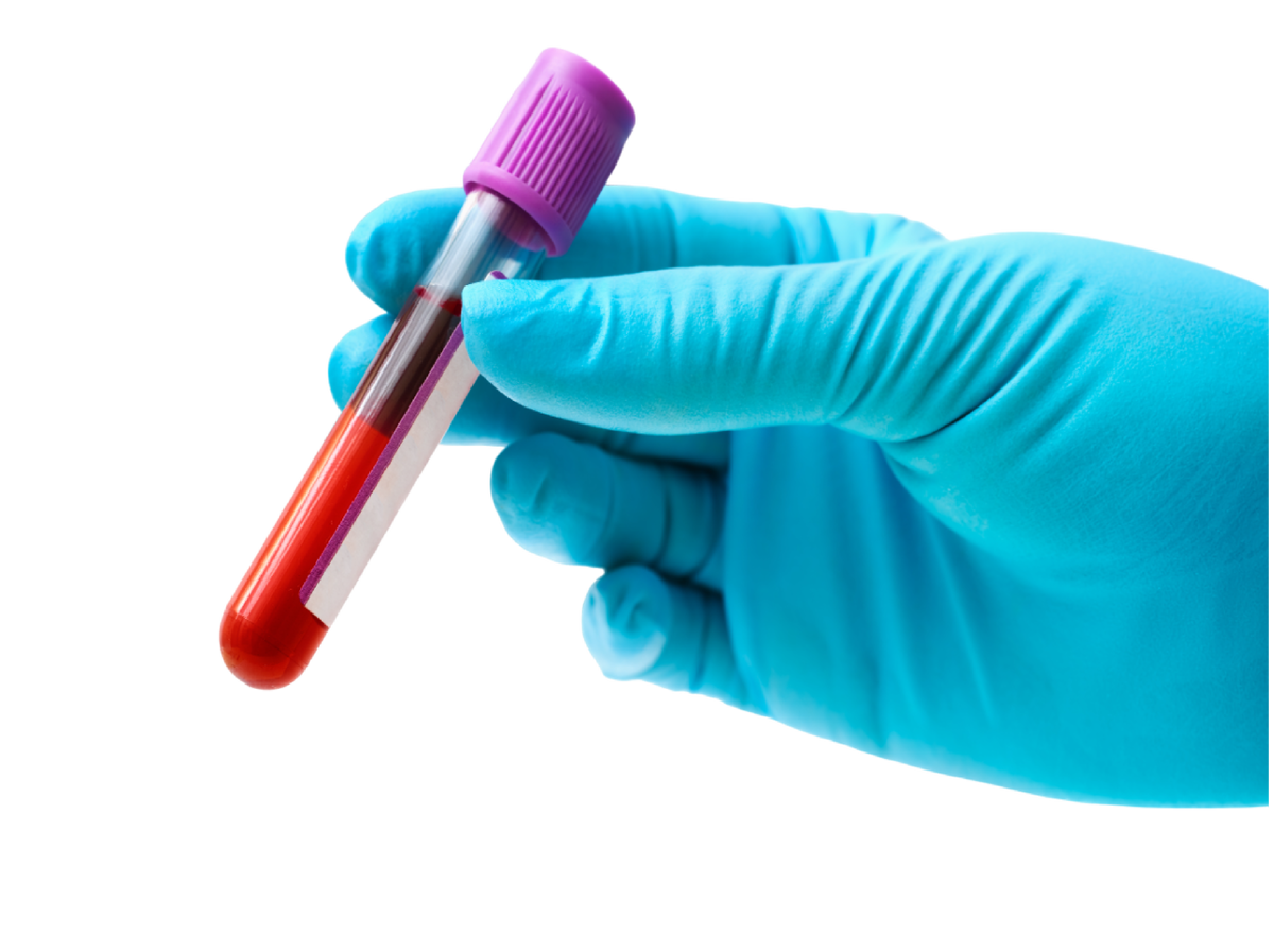  В данной статье мы разберем какие показатели отражает общий клинический анализ крови и о каких заболеваниях и патологических процессах говорит их отклонение. 