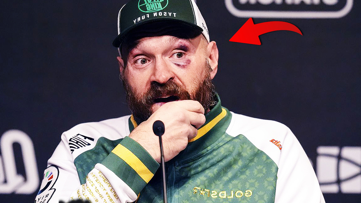 Тайсон Фьюри