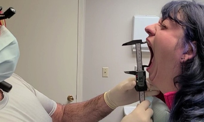    Американка попала в Книгу рекордов Гиннесса благодаря своему большому рту