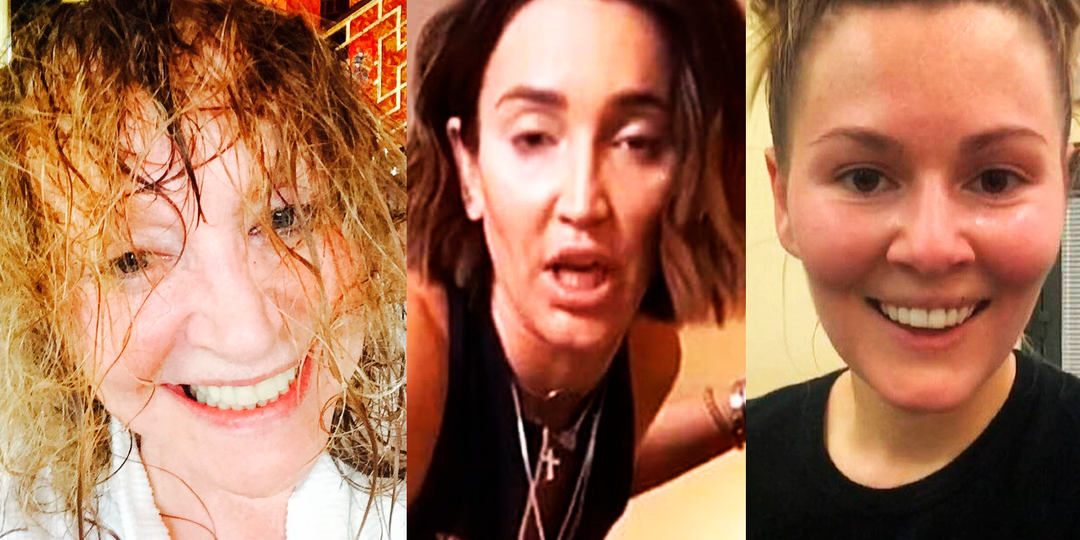 МДА. РОССИЙСКИЕ ЗВЁЗДЫ ДО И ПОСЛЕ МАКИЯЖА