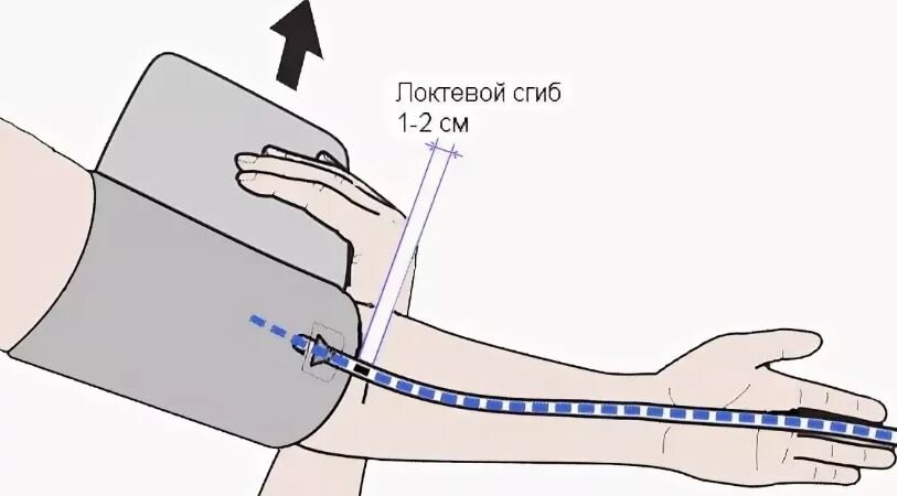 На пару пальцев вверх от локтевой ямки