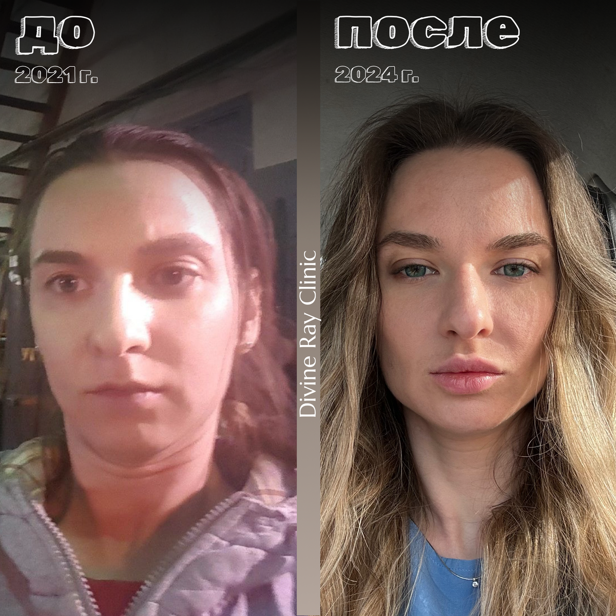 Косметология результаты до и после
