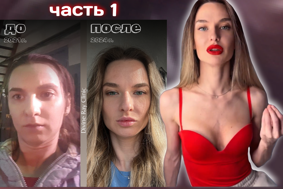 Возрастные изменения, как изменилась моя внешность за 3 года с 𝐃𝐢𝐯𝐢𝐧𝐞 𝐑𝐚𝐲 𝐂𝐥𝐢𝐧𝐢𝐜