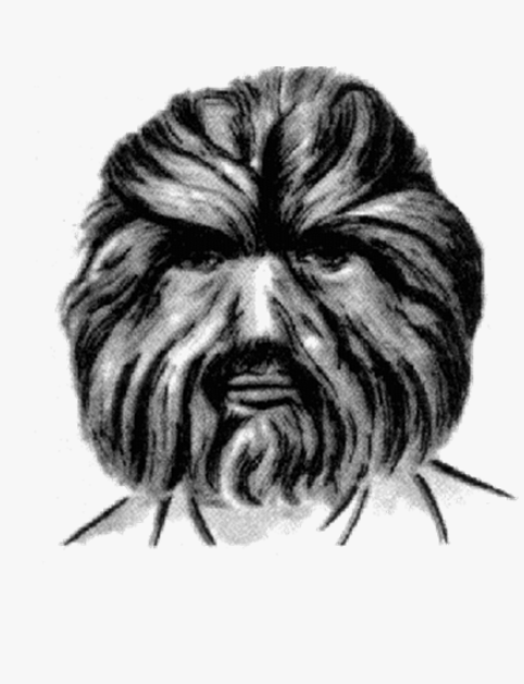 Иллюстрация человека с аномальным волосяным покровом. / Фото: playbookpro.ru