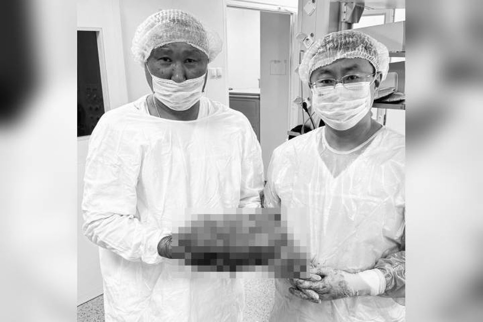    Эксперты провели полную диагностику и взялись за удаление опухоли. Фото: Бурятский онкологический диспансер.