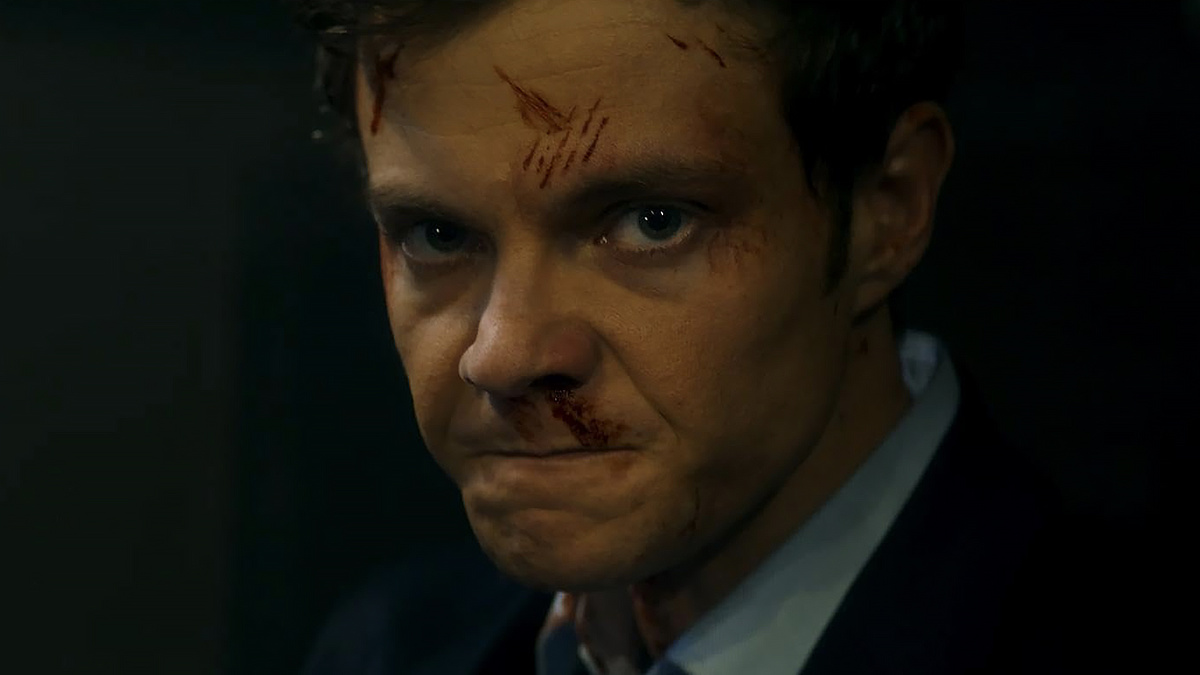 Кадр из фильма "Новокаин"