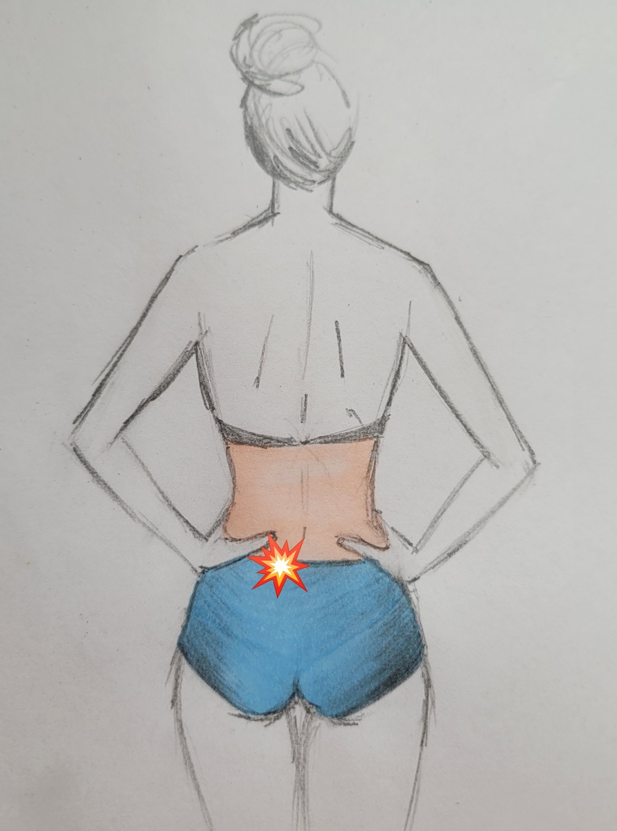 L5-S1 — это граница поясничного и крестцово-копчикового отделов позвоночника. Здесь чаще всего возникают межпозвонковые грыжи