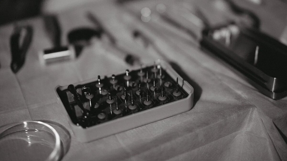 Можно ли снять зубной мост и поставить обратно?