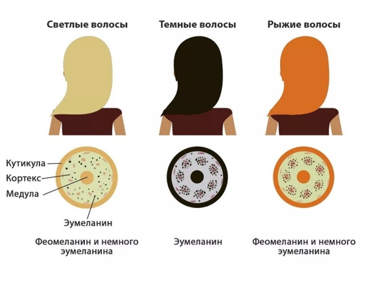 -5