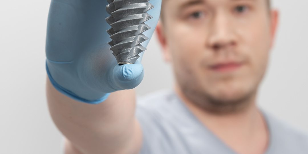 Имплантация зубов: мифы и реальность.