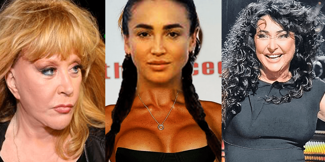 ЗРЕЛИЩЕ НЕ ДЛЯ СЛАБОНЕРВНЫХ! НАШИ ЗВЁЗДЫ ДО И ПОСЛЕ ПЛАСТИКИ